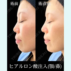 HAAB×DREAM BEAUTY CLINIC 東京本院 佐野 圭医師の症例