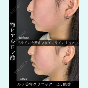 ルラ美容クリニック 札幌院 能登 貴弘医師の症例