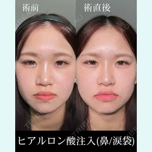 HAAB×DREAM BEAUTY CLINIC 大阪梅田院 柏木 太雅医師の症例