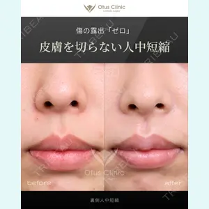 症例