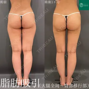 オアシス美容外科 遠藤 剛史医師の症例