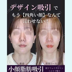 ルラ美容クリニック 京都院 矢田 玲奈医師の症例