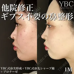 YBC横浜美容外科 大宮院 磯村 亮輔医師の症例