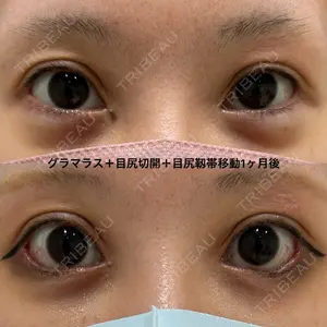 エターナル美容クリニック 久門田 詳医師の症例