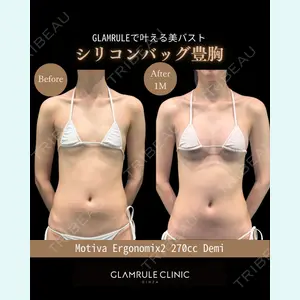 GLAMRULE CLINIC (グラムルール クリニック) 銀座院 藤林 万里子医師の症例