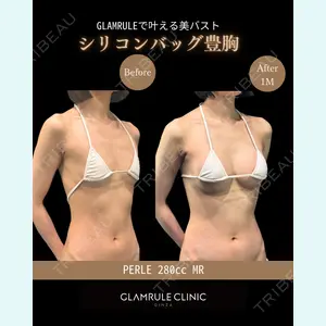 GLAMRULE CLINIC (グラムルール クリニック) 銀座院 藤林 万里子医師の症例