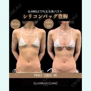 GLAMRULE CLINIC (グラムルール クリニック) 銀座院 藤林 万里子医師の症例