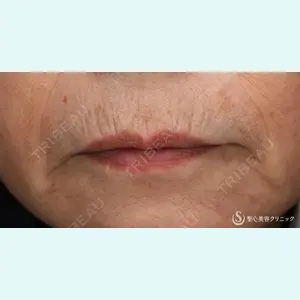 聖心美容クリニック 熱海院 小林 美幸（皮膚科）医師の症例