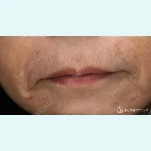 聖心美容クリニック 熱海院 小林 美幸（皮膚科）医師の症例