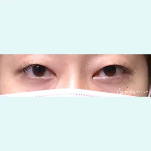 聖心美容クリニック 福岡院 美原 寿之医師の症例
