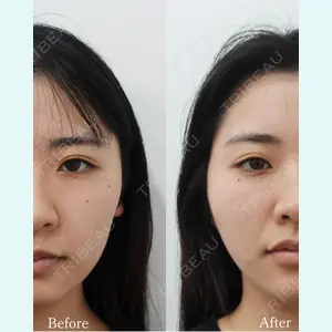 L‘amour clinic Tokyo【ラムールクリニック東京】の症例