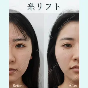 L‘amour clinic Tokyo【ラムールクリニック東京】の症例