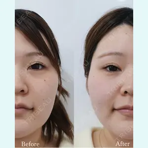 L‘amour clinic Tokyo【ラムールクリニック東京】の症例