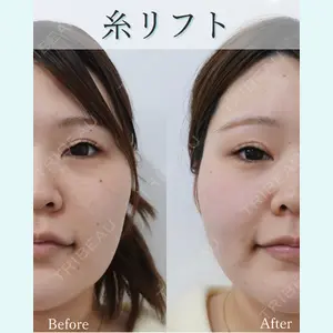 L‘amour clinic Tokyo【ラムールクリニック東京】の症例