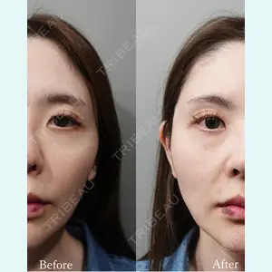 L‘amour clinic Tokyo【ラムールクリニック東京】の症例