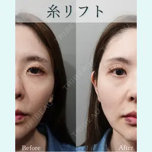 L‘amour clinic Tokyo【ラムールクリニック東京】の症例