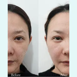 L‘amour clinic Tokyo【ラムールクリニック東京】の症例