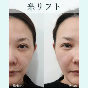 L‘amour clinic Tokyo【ラムールクリニック東京】の症例