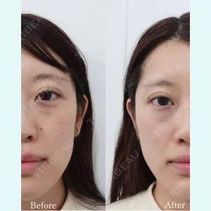 L‘amour clinic Tokyo【ラムールクリニック東京】の症例