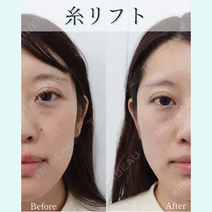 L‘amour clinic Tokyo【ラムールクリニック東京】の症例