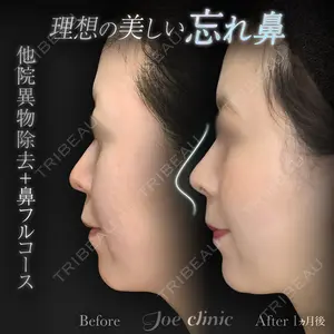 ジョウクリニック 高知院 溝渕　貴俊医師の症例