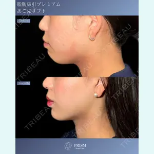 PRISM Beauty Clinicの症例