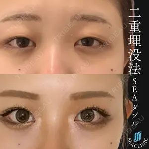 SEA CLINIC（シークリニック） 沼澤 茂医師の症例