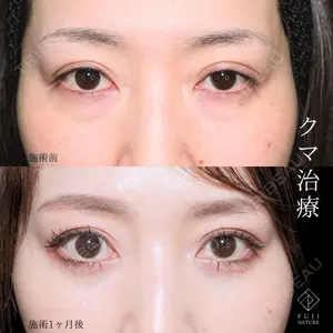 症例