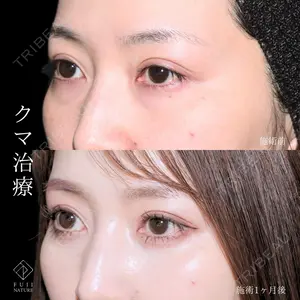症例