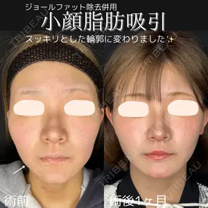 症例