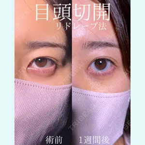 症例
