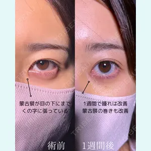 症例