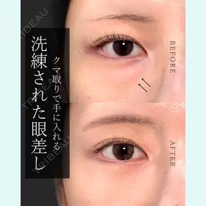 東京形成美容外科 船橋院 弓削田　浩主医師の症例