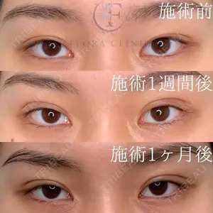 フローラクリニック 秋間雄策（さくちゃん先生）医師の症例