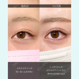 東京形成美容外科 船橋院 弓削田　浩主医師の症例