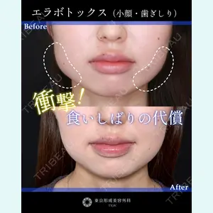 症例