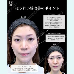 症例