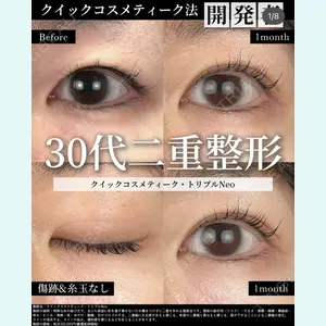 湘南美容クリニック 大阪梅田院の症例