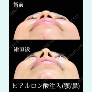 HAAB×DREAM BEAUTY CLINIC 東京本院 佐野 圭医師の症例