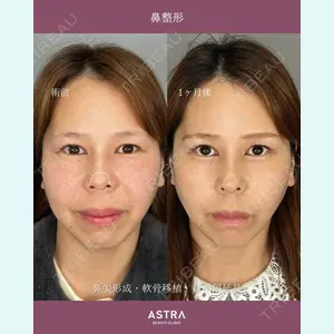 ASTRA BEAUTY CLINIC 権　友貴医師の症例