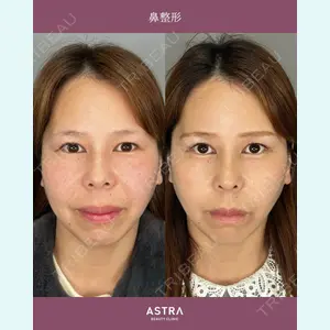 ASTRA BEAUTY CLINIC 権　友貴医師の症例