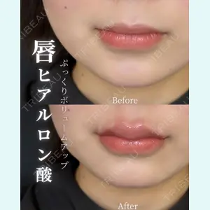 症例