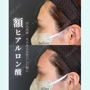症例