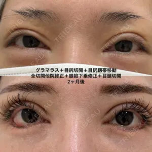 エターナル美容クリニック 久門田 詳医師の症例