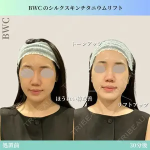 ビューティー和心クリニック 浅草院の症例