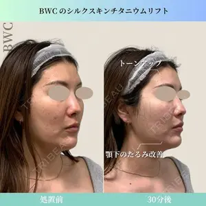 ビューティー和心クリニック 浅草院の症例