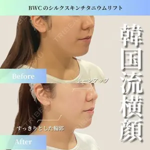 ビューティー和心クリニック 浅草院の症例