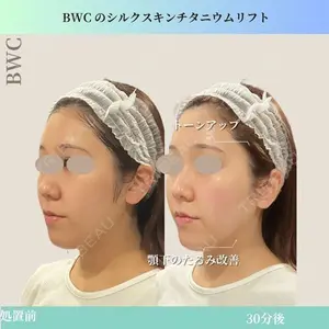 ビューティー和心クリニック 浅草院の症例