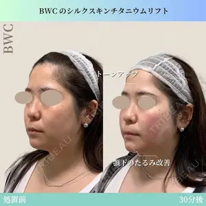 ビューティー和心クリニック 浅草院の症例
