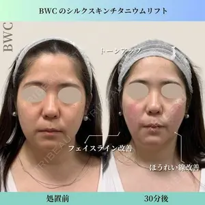 ビューティー和心クリニック 浅草院の症例